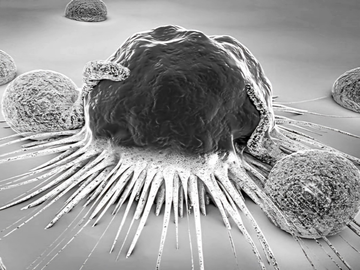 Reclaman políticas públicas contra el cáncer